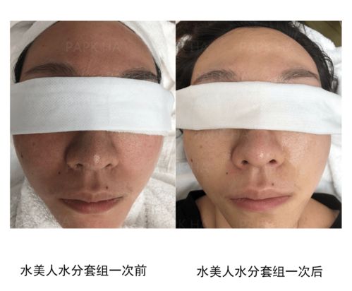 皮肤管理与生活美容 专业差异与生活服务